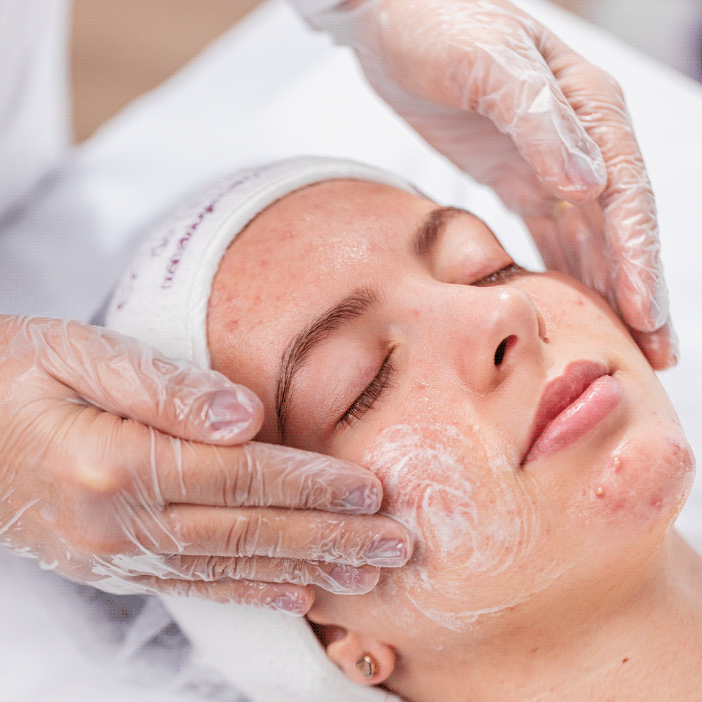 Kit para Limpeza de Pele Acneica