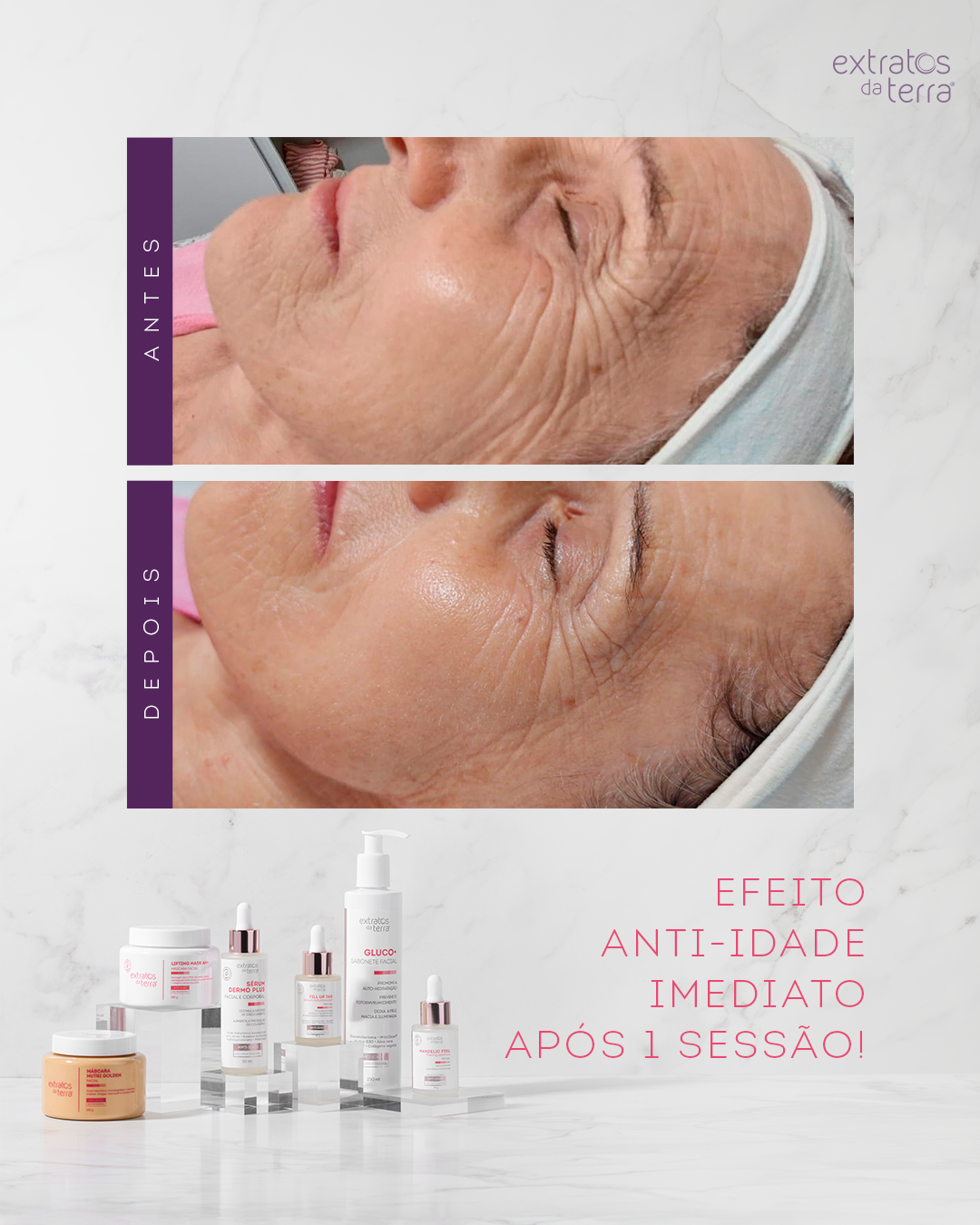 Kit Tratamento anti-idade Profissional